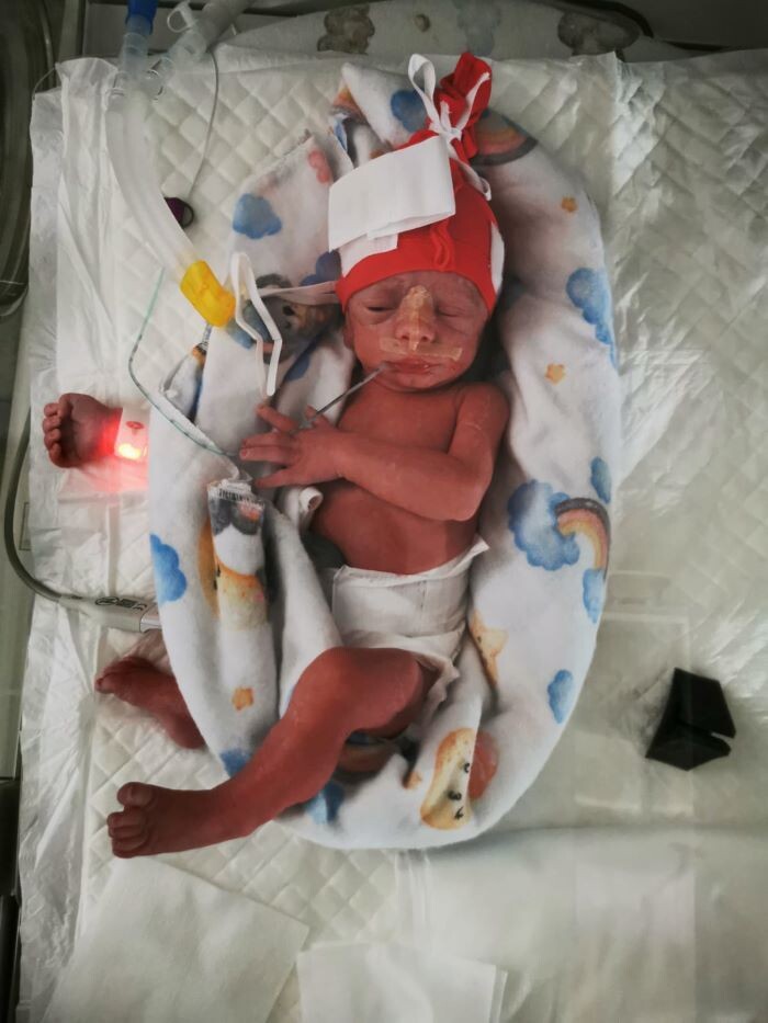 Narodziny trojaczków w Szpitalu Miejskim/fot. Szpital Miejski w Rudzie Śląskiej