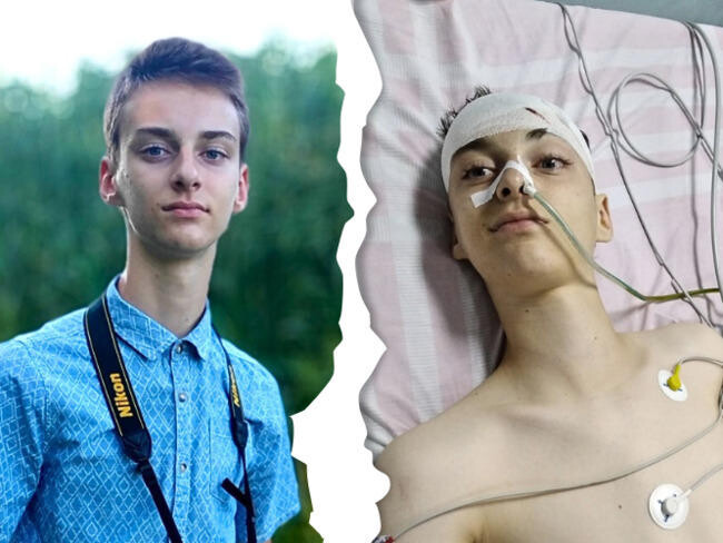 Zaczęło się od bólu nogi. Diagnoza - rak mózgu. Trwa zbiórka na rehabilitację Tymoteusza